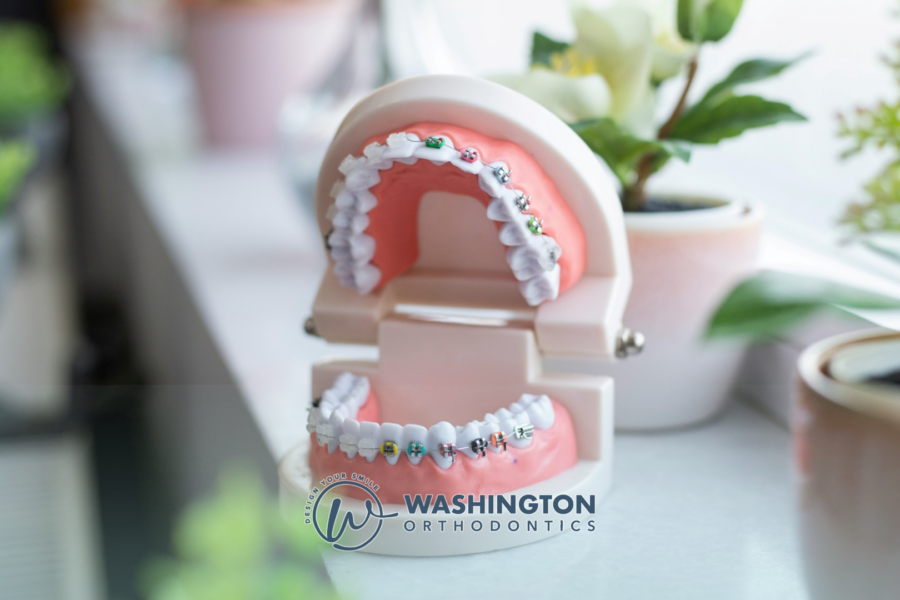 Learn orthodontists consultation costs in Factoria, Bellevue, and Washington State