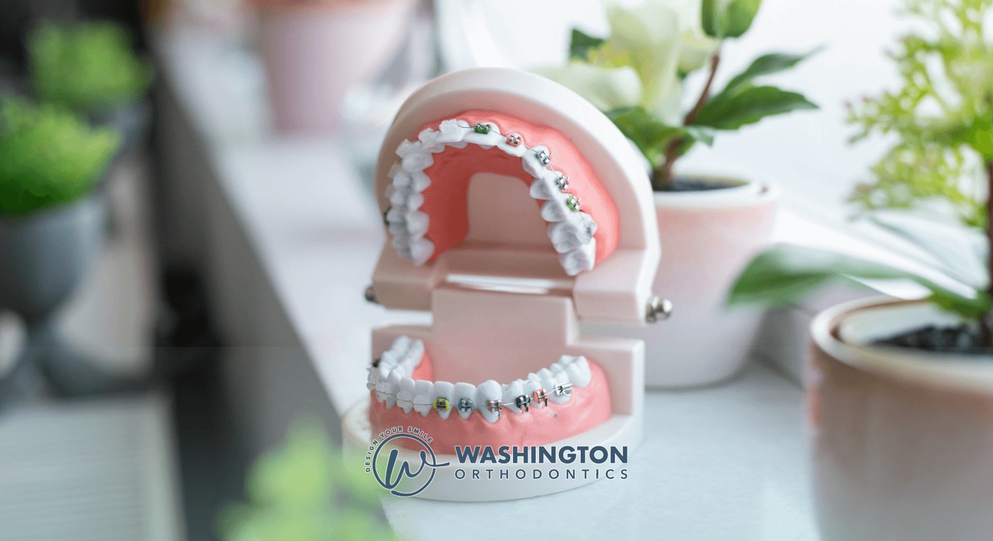 Learn orthodontists consultation costs in Factoria, Bellevue, and Washington State