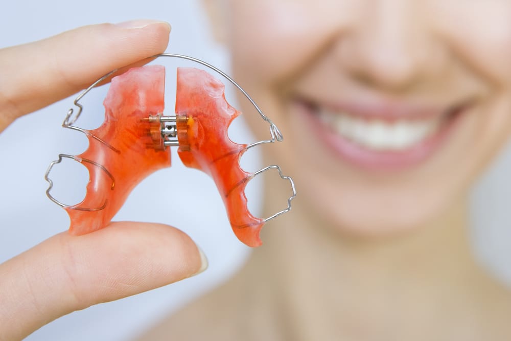 A woman holds a red dental retainer, smiling in the background - Washington Orthodontics A woman holds a red dental retainer, smiling in the background - Washington Orthodontics